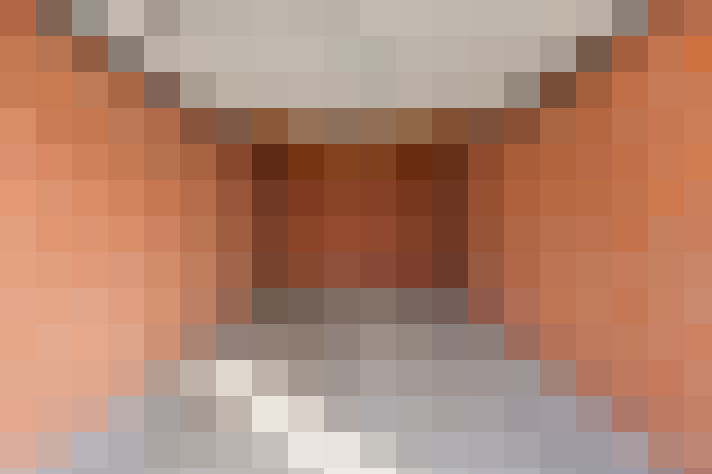  / #18