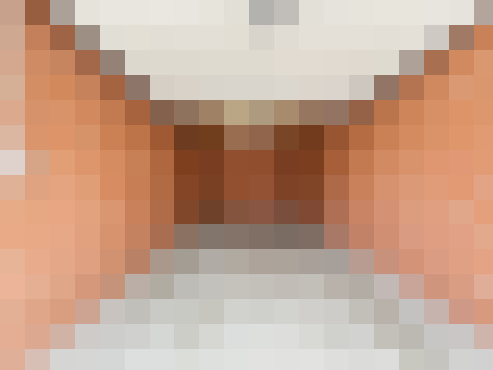  / #21
