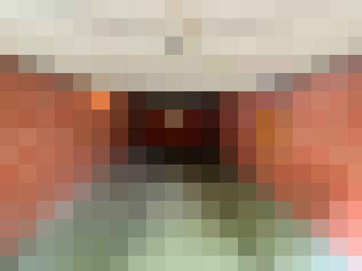  / #17