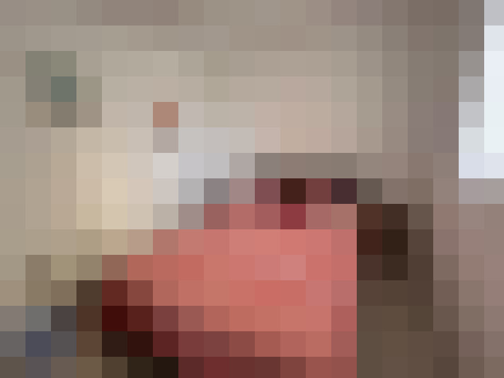  / #7